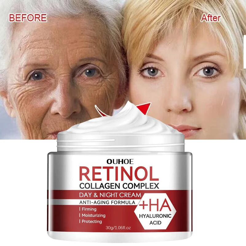 Retinol Cream - Crema al retinolo idratante per la