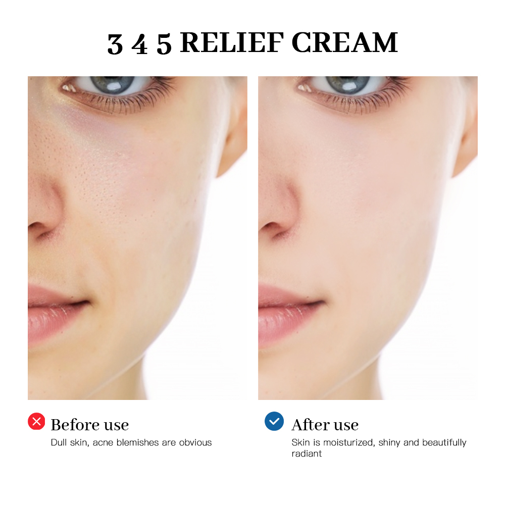 345 Crema Sollievo Soluzione c - Retinol Cream recensione e prezzo