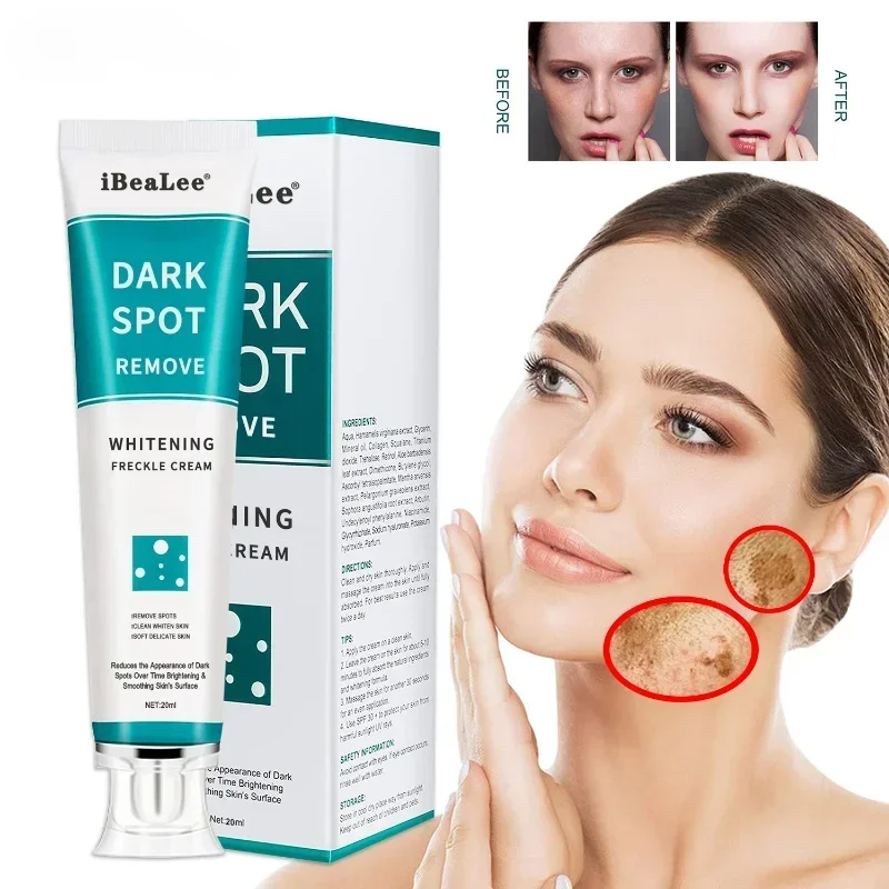 Crema sbiancante per lentiggin - Skincare Glowing recensione e prezzo