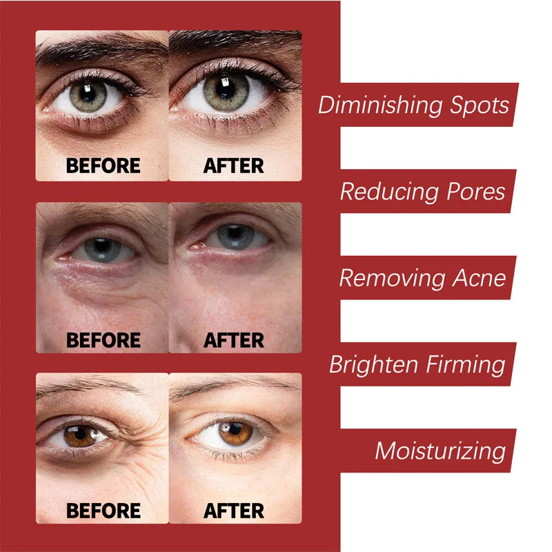 Crema al retinolo idratante pe - Retinol Cream recensione e prezzo