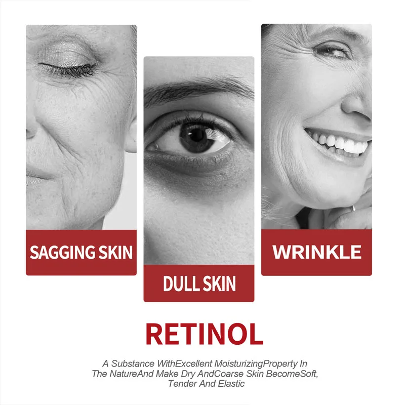 Crema al retinolo idratante pe - Retinol Cream recensione e prezzo