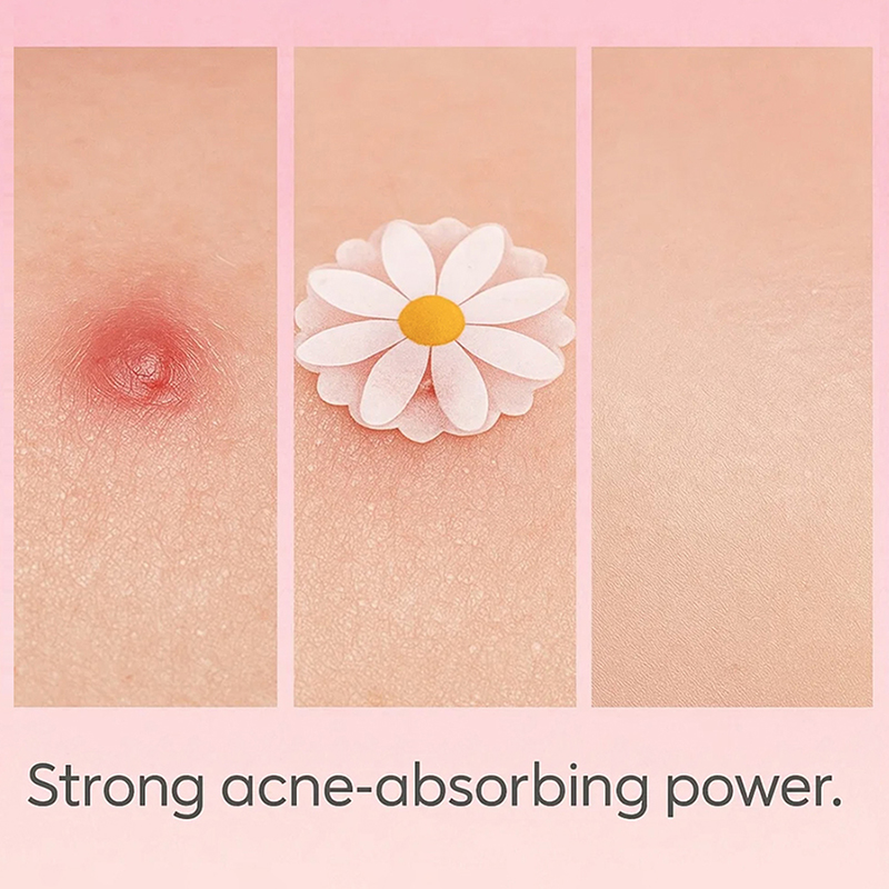 100 pezzi Cerotti per la Cura  - Skincare China recensione e prezzo