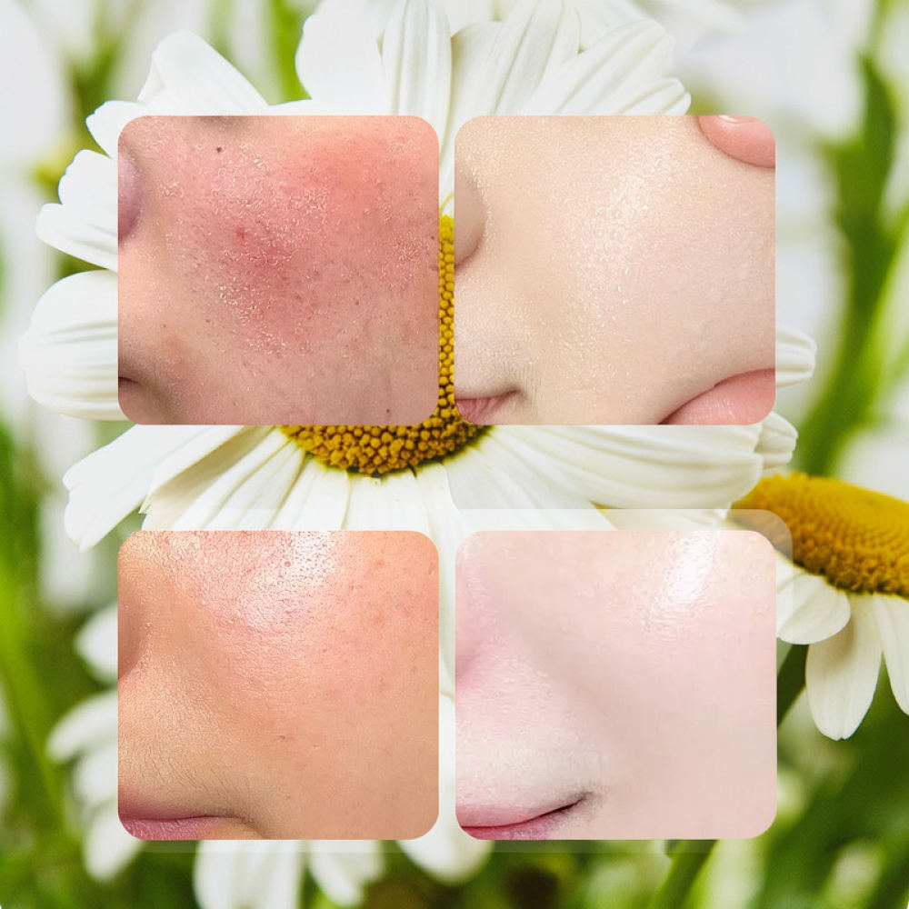 Maschera Viso in Foglio Fykly  - Face Mask Skincare recensione e prezzo